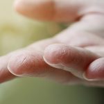 خشکی پوست چیست علل وعوامل کدام است؟